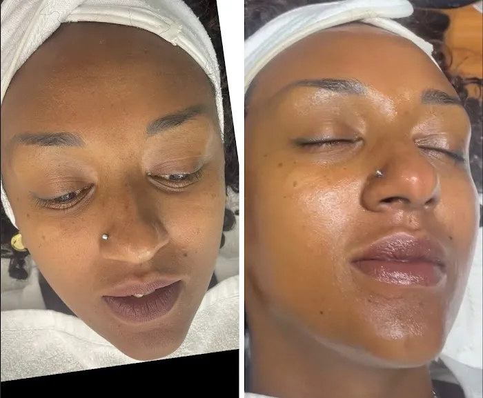 Maraki Skin Picture 4