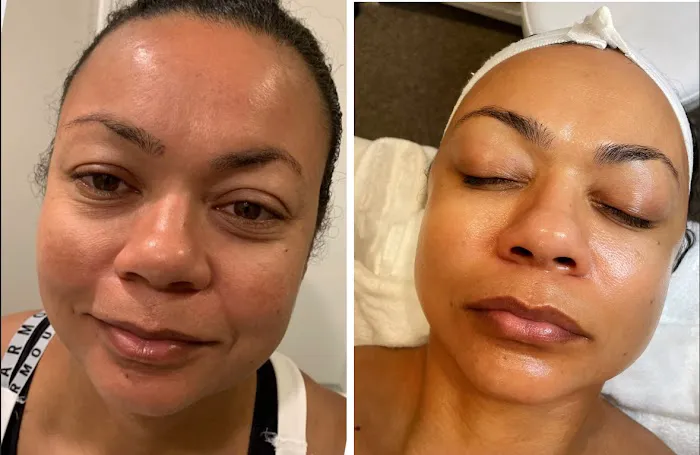 Maraki Skin Picture 9