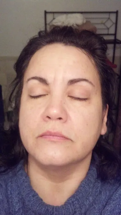 Cary Skin Care Picture 6