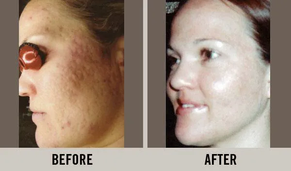 Cary Skin Care Picture 5