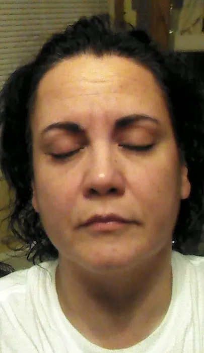 Cary Skin Care Picture 10