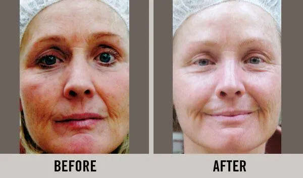 Cary Skin Care Picture 4