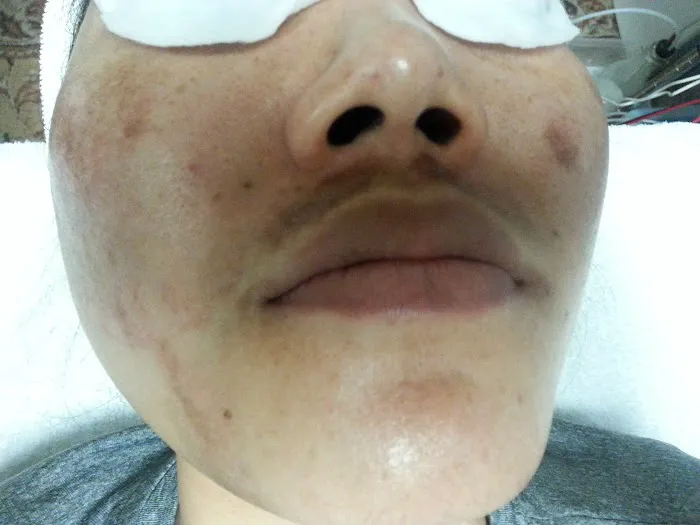 Cary Skin Care Picture 1