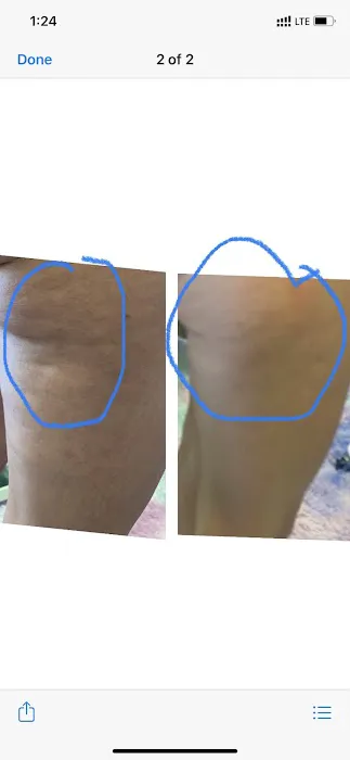 Body-RiteLLC Picture 1