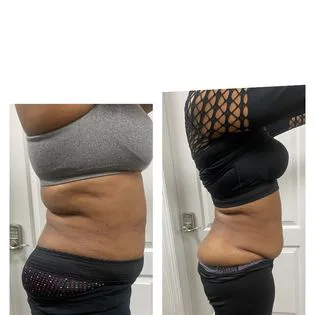 Body-RiteLLC Picture 6