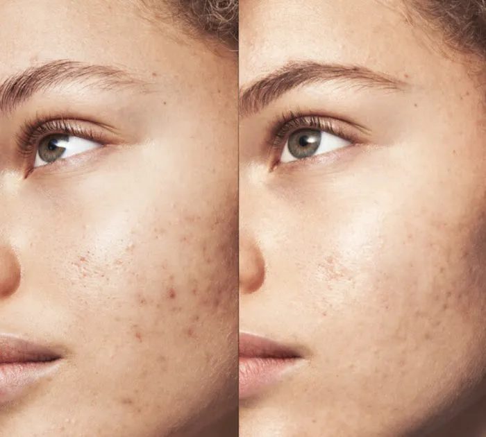 S-TEEM SKIN Picture 5