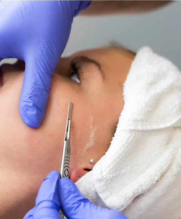 S-TEEM SKIN Picture 10