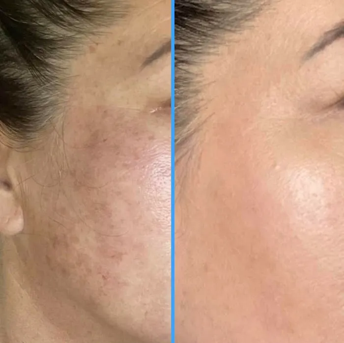 S-TEEM SKIN Picture 9