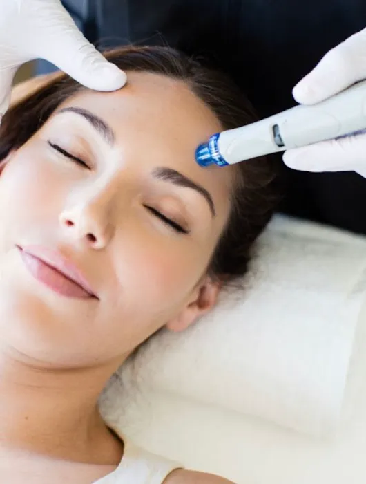 Custom Skin NC Picture 4