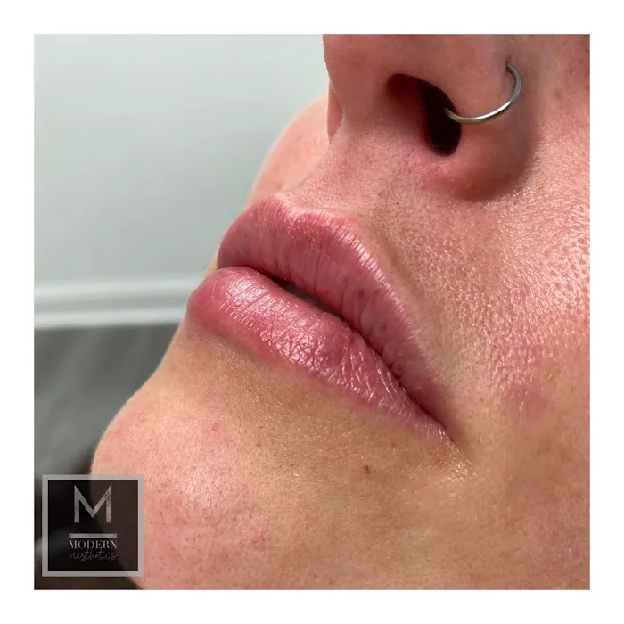 Modern Aesthetics Picture 6