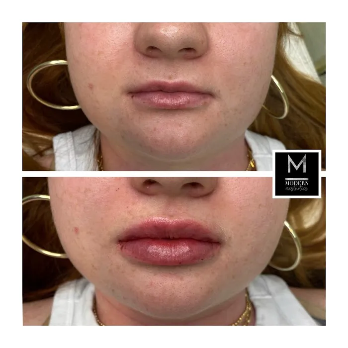 Modern Aesthetics Picture 7