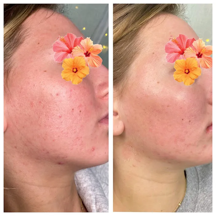 Modern Aesthetics Picture 9