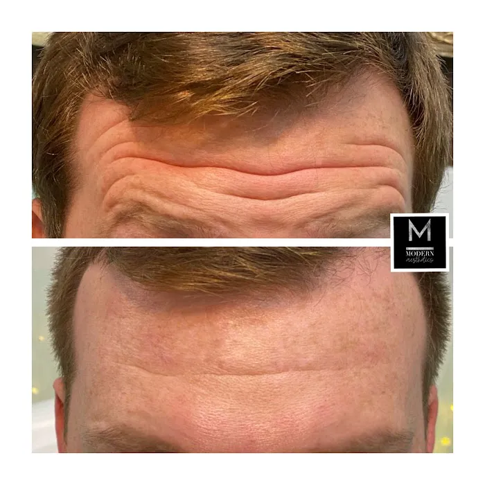 Modern Aesthetics Picture 8