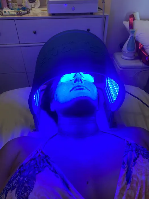 Babyface Medspa Picture 9