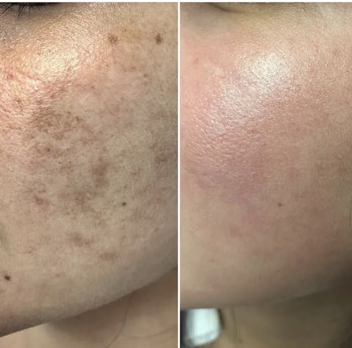 SkinFit by Anneliese Picture 5