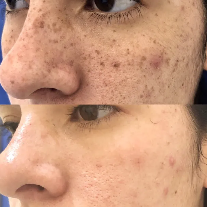 SkinFit by Anneliese Picture 2