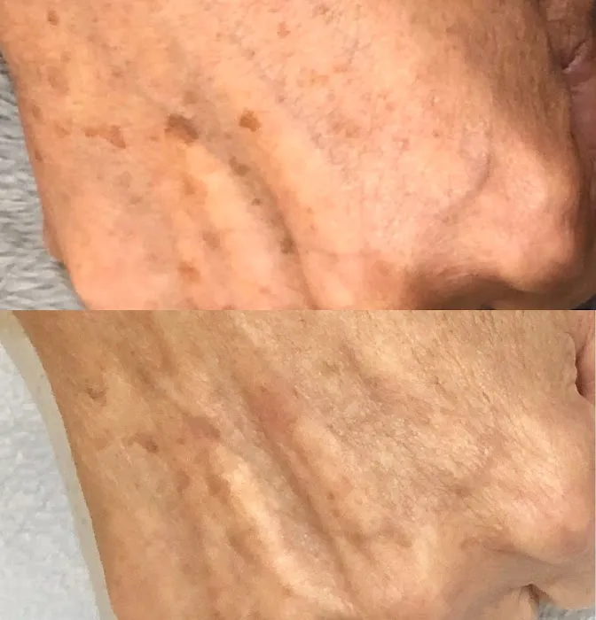 SkinFit by Anneliese Picture 6