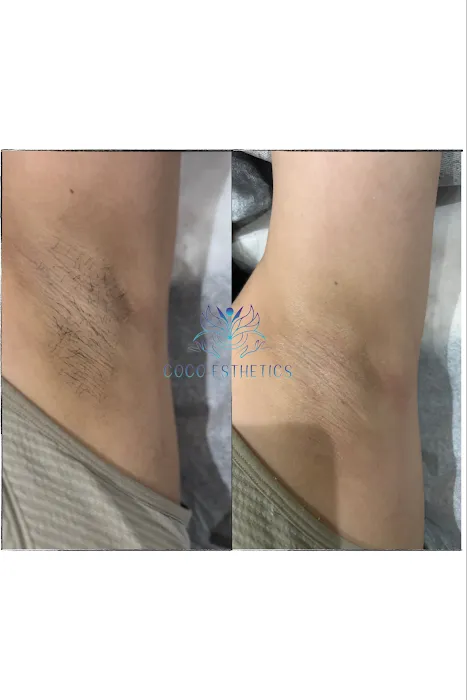 Coco Esthetics Picture 4