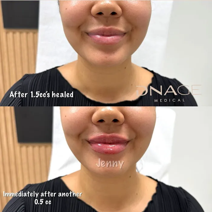 DNAge Medical Picture 5