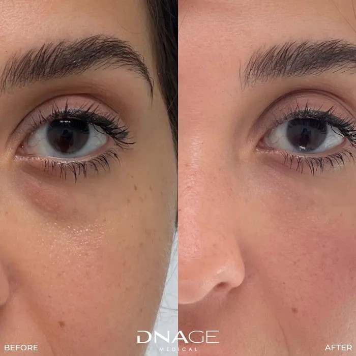 DNAge Medical Picture 8