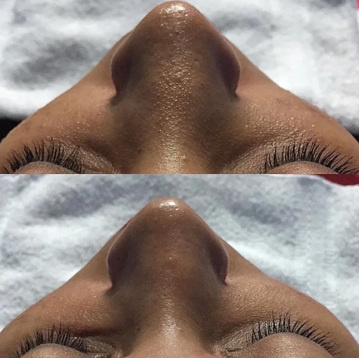 Liz Skincare Picture 10