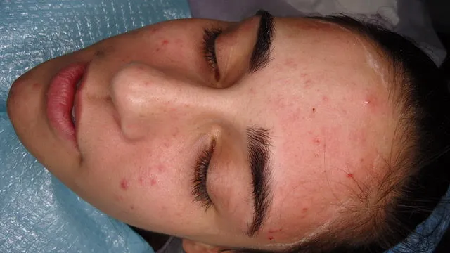 IN SKIN Inc Picture 2