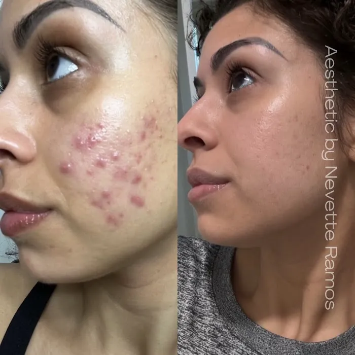 Aesthetic by Nevette Ramos Picture 5