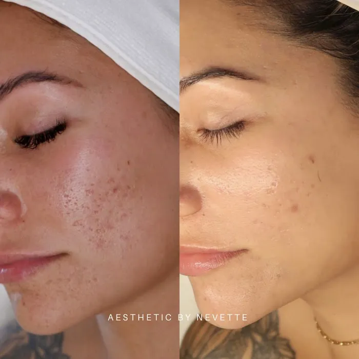 Aesthetic by Nevette Ramos Picture 2