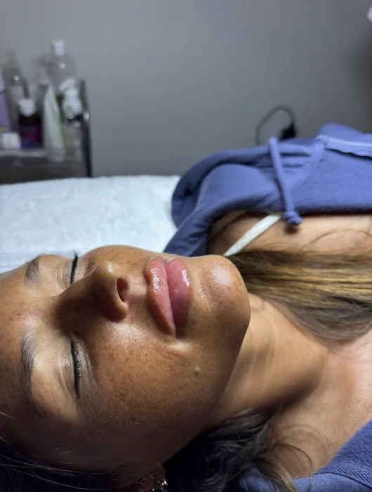 Verbena Skin Clinic Picture 4