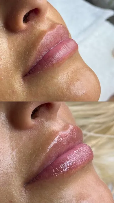 Verbena Skin Clinic Picture 5