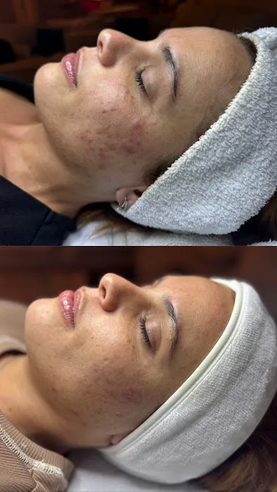 Verbena Skin Clinic Picture 6