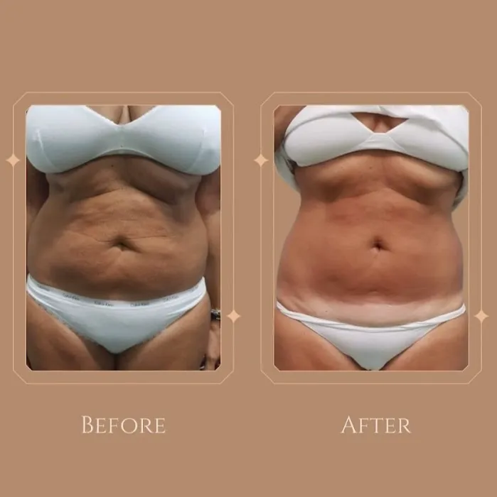 Dolce Vita Aesthetics Picture 7