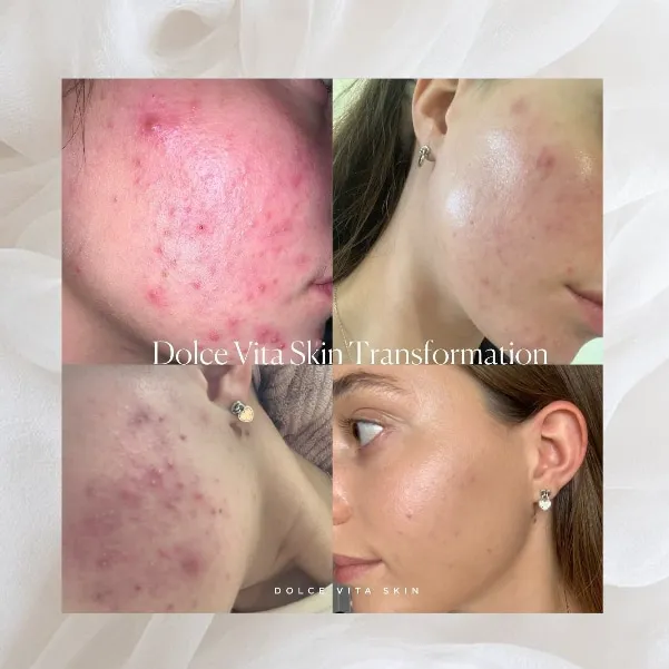 Dolce Vita Aesthetics Picture 5