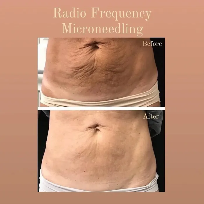 Dolce Vita Aesthetics Picture 8