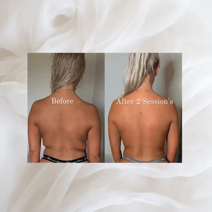 Dolce Vita Aesthetics Picture 9