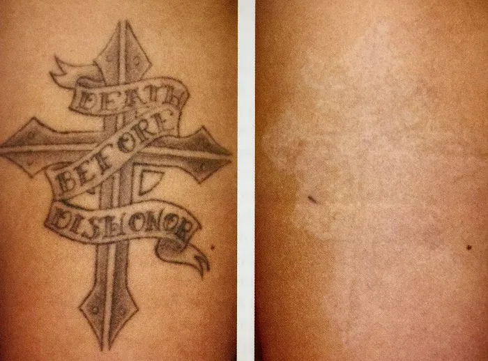 Elite Aesthetics Group Picture 1