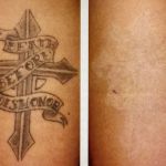 Elite Aesthetics Group