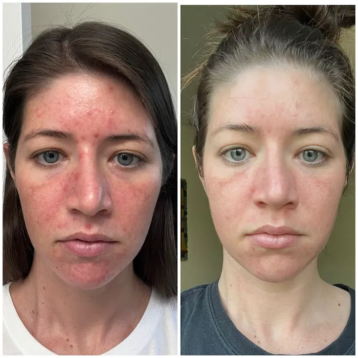 Inventori Skin Picture 4