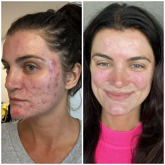 Inventori Skin Picture 5