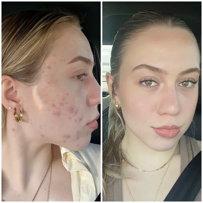 Inventori Skin Picture 6