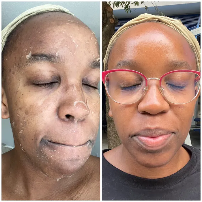 Inventori Skin Picture 3