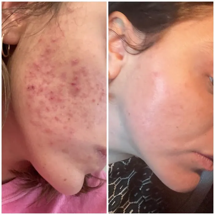 Inventori Skin Picture 7