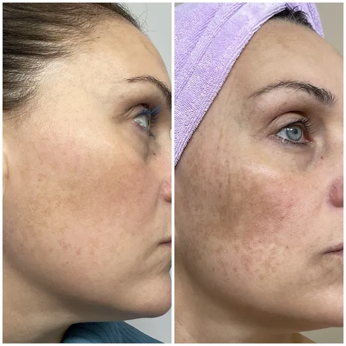 Inventori Skin Picture 2