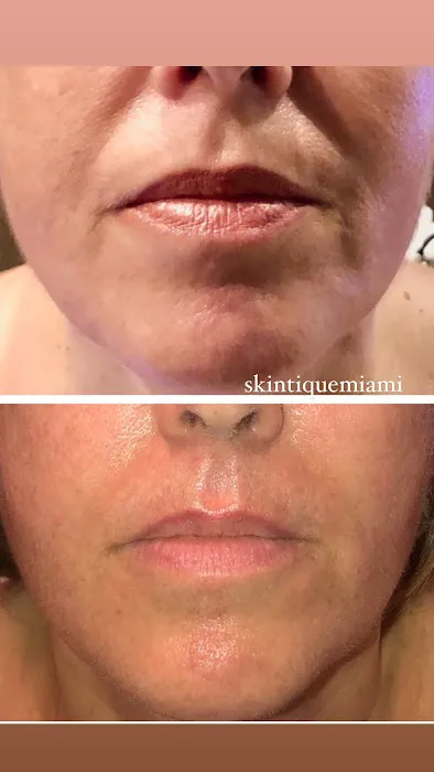 Skintique Miami Picture 2