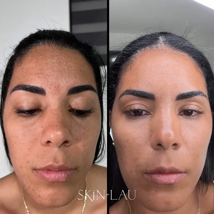 Skin By Lau Picture 4