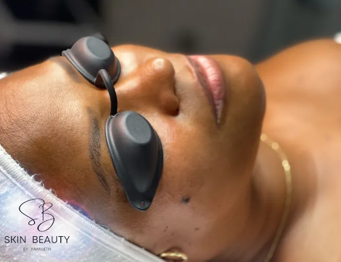 Skin Beauty by Yamileth Picture 7