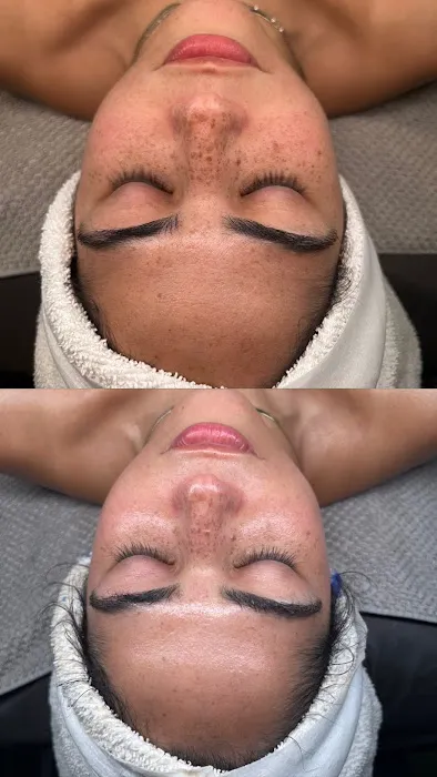 Opulent skin Miami Picture 1