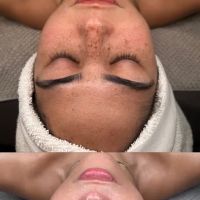 Opulent skin Miami ico