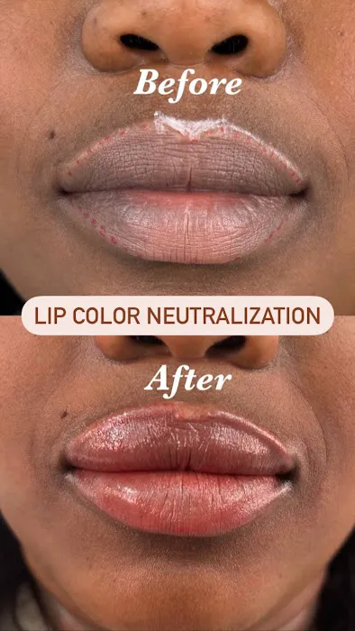 Opulent skin Miami Picture 2