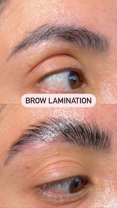 Opulent skin Miami Picture 4